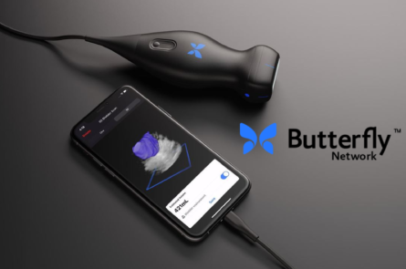 Butterfly Network iQ Probe